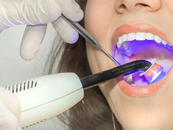 گامی مهم در جهت ایجاد مینای بیولوژیکی دندان با استفاده از سلول‌های بنیادی 