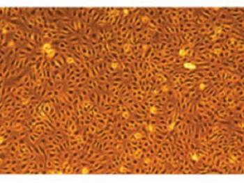 چگونه متابولیسم روی بلوغ سلول های اندوتلیالی مشتق از سلول های iPS تاثیر می گذارد