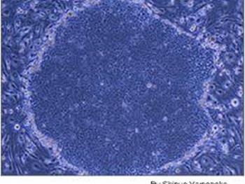 درمان بیماری های ایسکمیک با استفاده از سلول های iPS انسانی