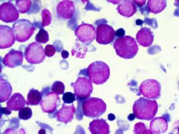 مطالعه ای در زمینه سرطان ممکن است به تولید سلول های بنیادی خونی قابل استفاده کمک کند