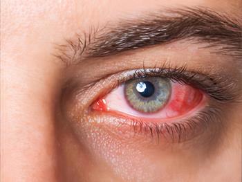 یک گزینه درمانی جدید برای بیماران مبتلا به سرطان چشم