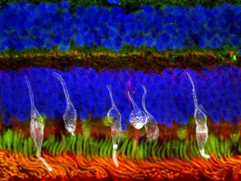 درمان نابینایی از طریق پیوند سلول‌های پیش ساز گیرنده نور