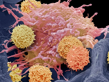 استفاده از سلول‌هایCAR-T  برای درمان اختلالات خودایمنی 
