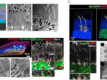 ارگانوئید/سلول‌های شبکیه مشتق از سلول‌های بنیادی پرتوان برای درمان‌های بازسازی شبکیه 