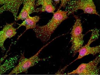 سلول‌ها‌ی بنیادی ممکن است به شناسایی داروهای جدید اسکیزوفرنی کمک کند