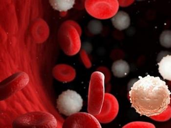 بهبود درمان سرطان خون لوسمی سلول مویی