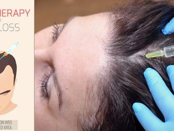 سلول درمانی موثر و اقتصادی برای بازسازی مو