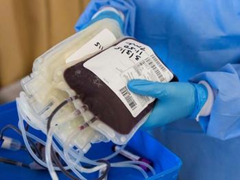 تاثیر جنسیت یا بارداری اهداکننده‌ی خون بر بقای بیماران