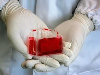  مقایسه پیوند خون بند‌ناف  و پیوند سلو‌ل‌های بنیادی خون‌محیطی