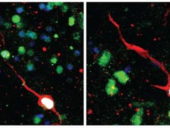 کشف نورون‌های نابالغ در هیپوکامپ مغز انسان