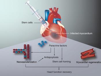 برنامه ریزی سلولی برای مدل سازی و درمان بیماری های قلبی عروقی 
