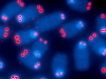 پیری زودرس در شرایط غیر کوتاه شدن تلومر در کروموزوم‌ها