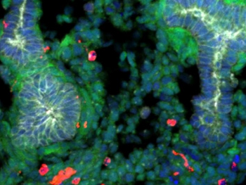 ایجاد ریه در موش با استفاده از سلول‌های بنیادی 