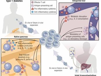 پیشرفت در درمان‌های تنظیم کننده سلول T برای دیابت نوع 1 و پیوند جزایر