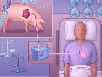 نتایج درمانی اولین قلب خوکی پیوند شده به انسان