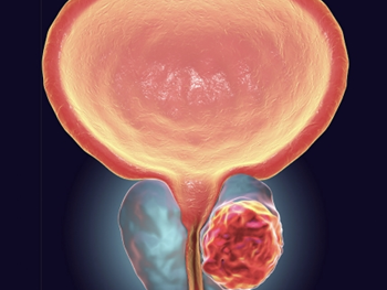 کمک به درمان و تشخیص بهتر سرطان پروستات با شناسایی یک عملکرد جدید