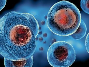 نقش پیوند سلول‌های بنیادی در درمان ام اس
