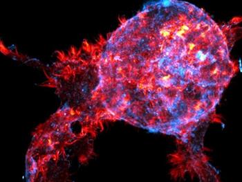 برآمدگی‌های سلولی چسبنده به مهار تومورهای سینه کمک می‌کند