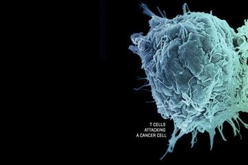 استفاده از سلول‌های T به عنوان سپری در  برابر تومورهای جامد