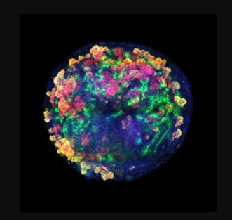  تولید ارگانوئیدهای کلیه انسانی در مقیاس انبوه و پیوند آزمایشی به کلیه خوک