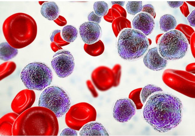 پیوند سلول‌های بنیادی، امید تازه برای جوانان مبتلا به ALL