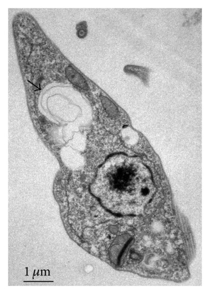 مشتقات اسید اورسولیک سلول‌های سرطانی را هدف می‌گیرند